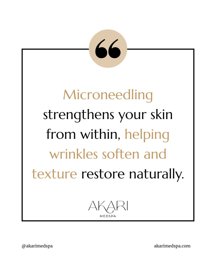 microneedling for wrinkles newport beach
